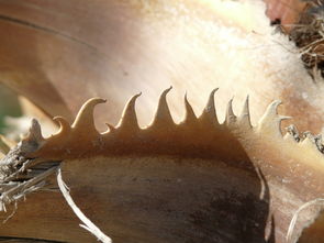 世界上最恶心的病是什么病?，世界上最恶劣的病